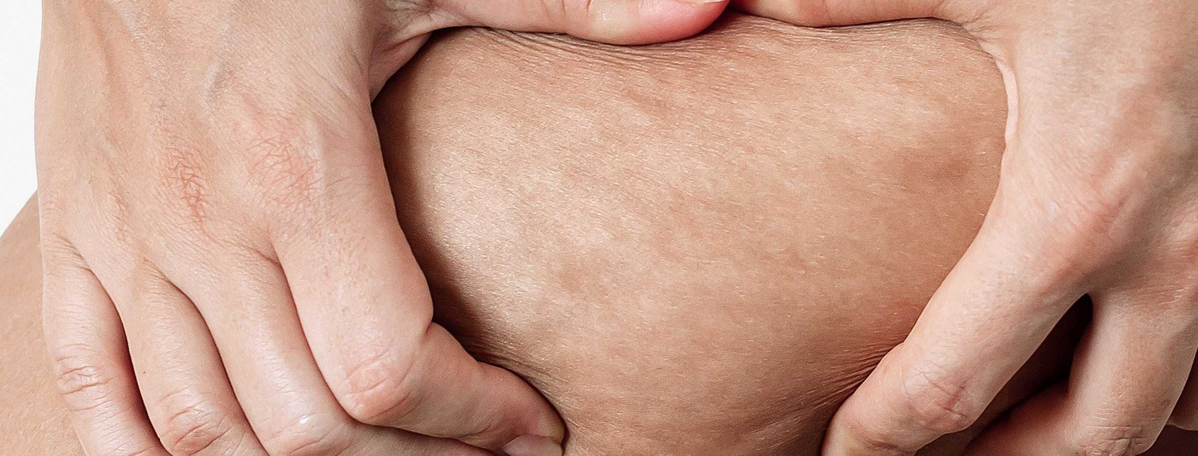 Treatments to Fight Cellulite and Localized Fat