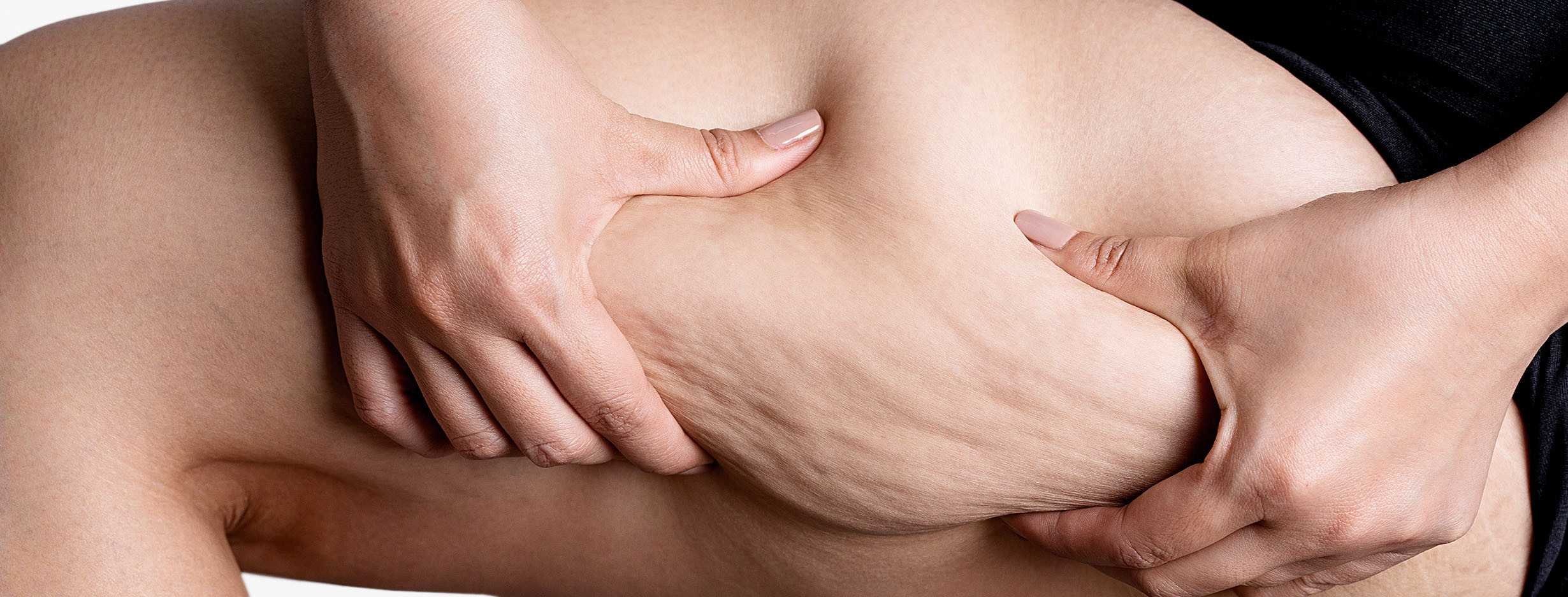 Draining and antioxidant supplements against water retention