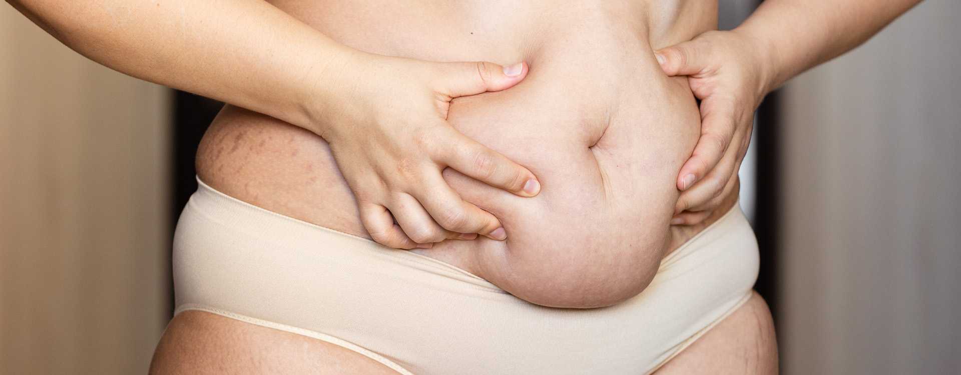 Postpartum tummy firming cream: which one to choose?