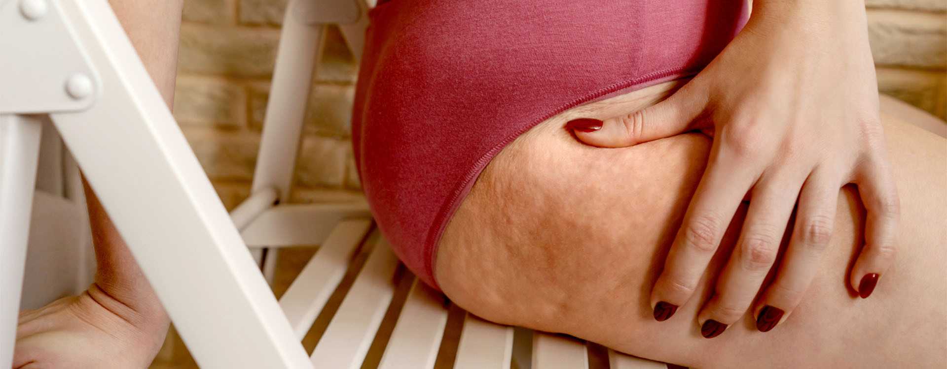 Painful cellulite: what it is, how to recognize it and what to do